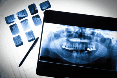 servicio radiografias